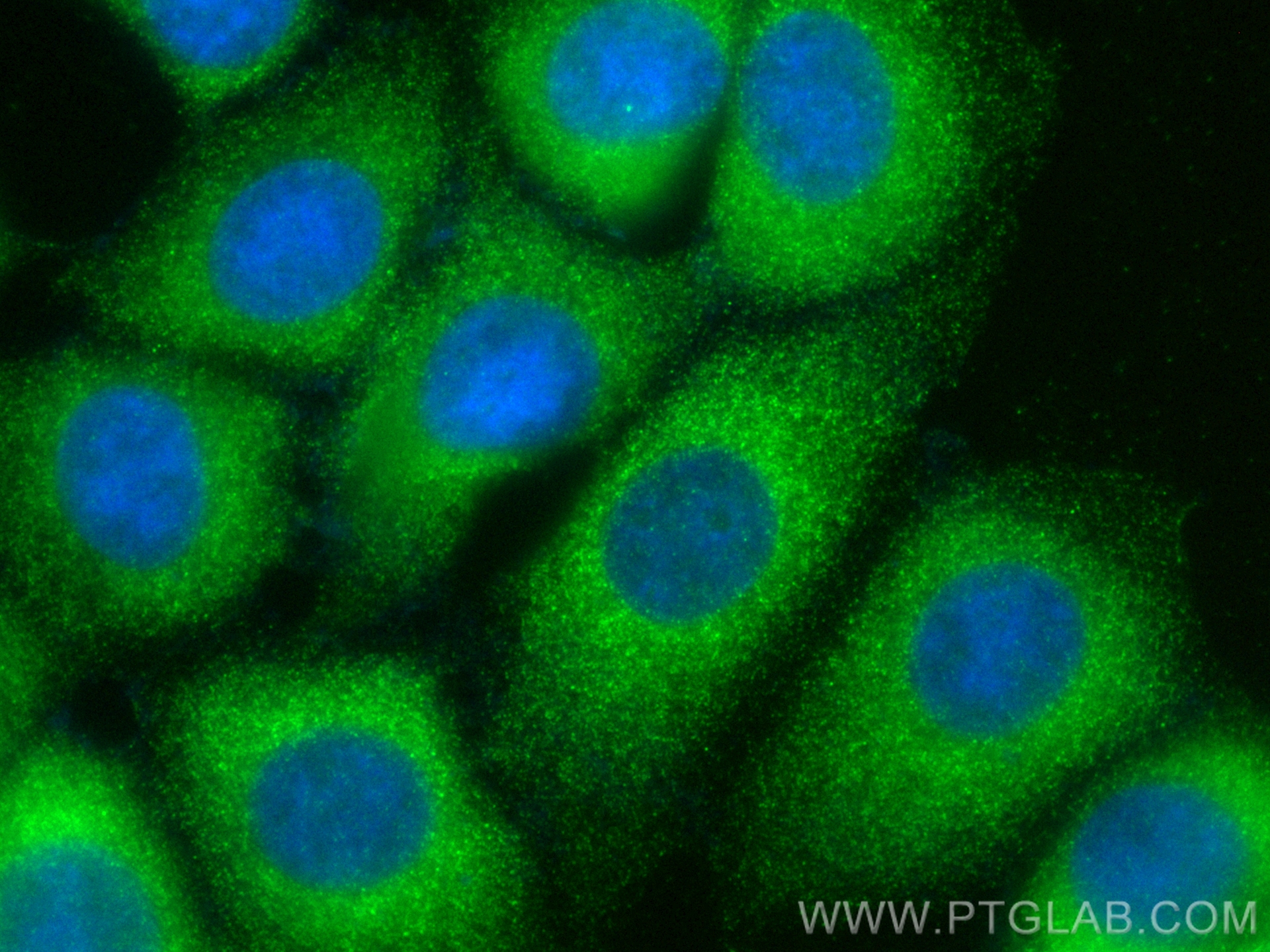 Immunofluorescence (IF) / fluorescent staining of MCF-7 cells using CoraLite® Plus 488-conjugated OPTN Polyclonal anti (CL488-10837)