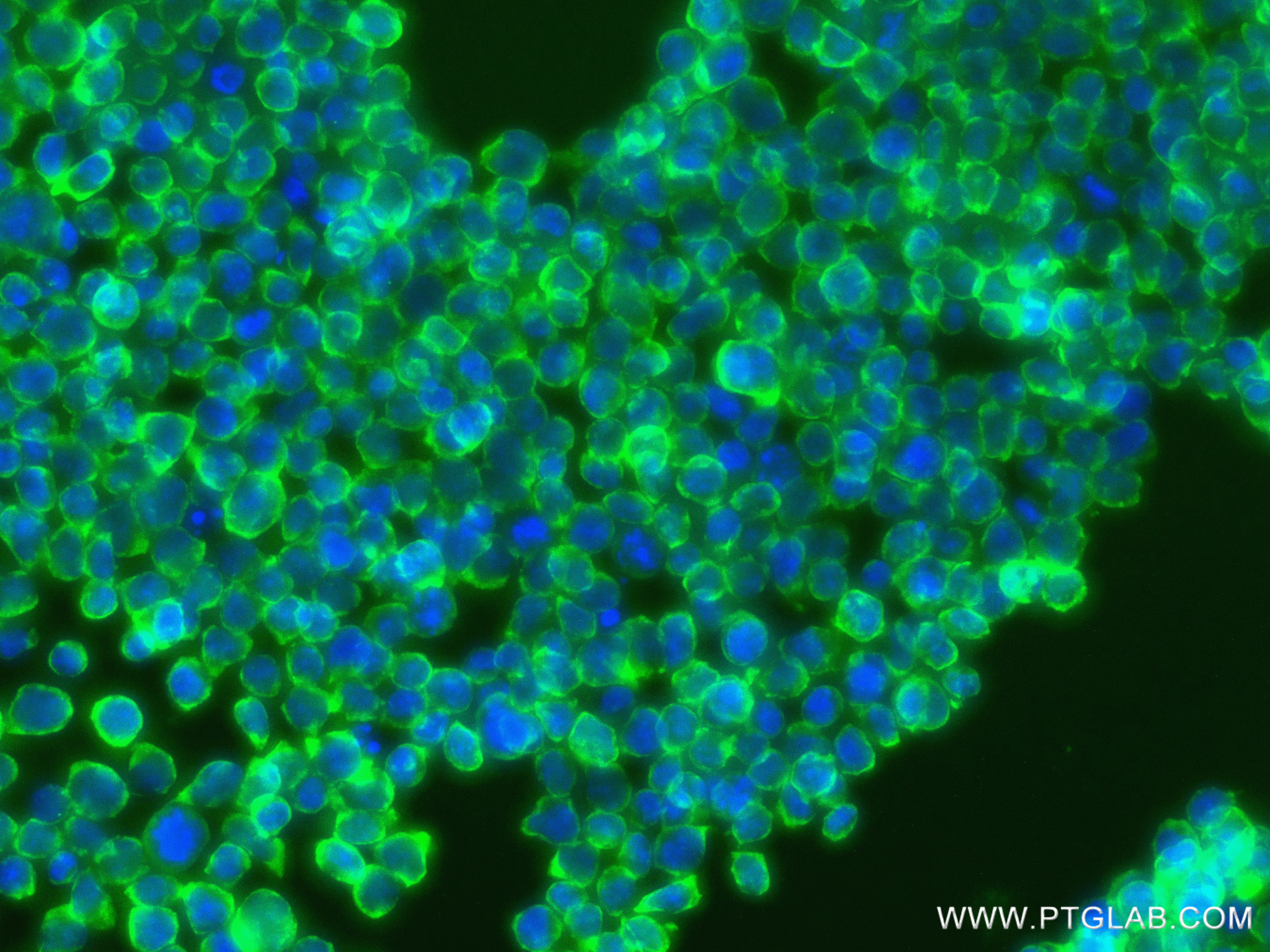 Immunofluorescence (IF) / fluorescent staining of Jurkat cells using ORAI3 Recombinant antibody (84340-2-RR)