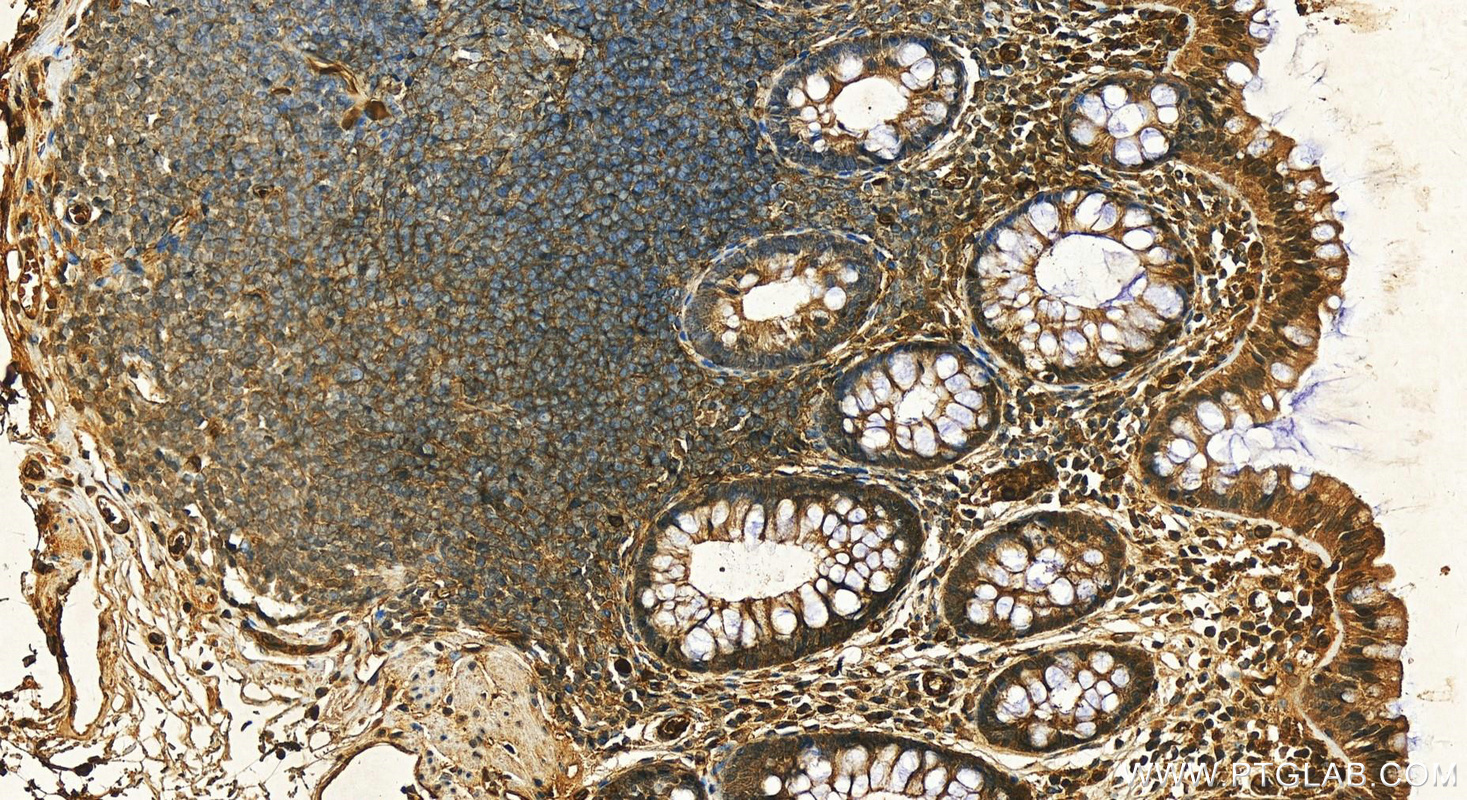 Immunohistochemistry (IHC) staining of human normal colon using ORM1 Polyclonal antibody (16439-1-AP)