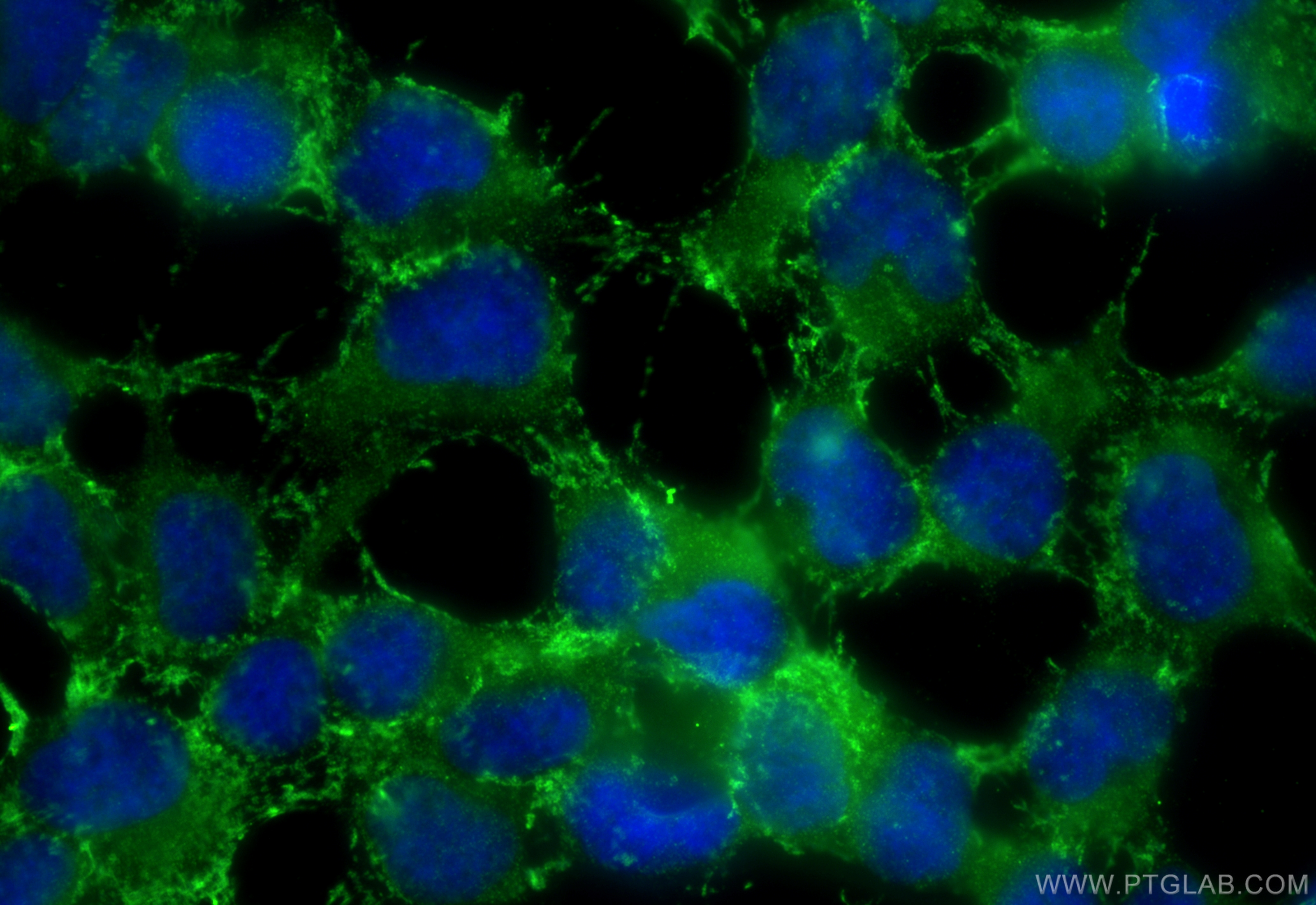 Immunofluorescence (IF) / fluorescent staining of HEK-293 cells using ORM1/2 Polyclonal antibody (11199-1-AP)