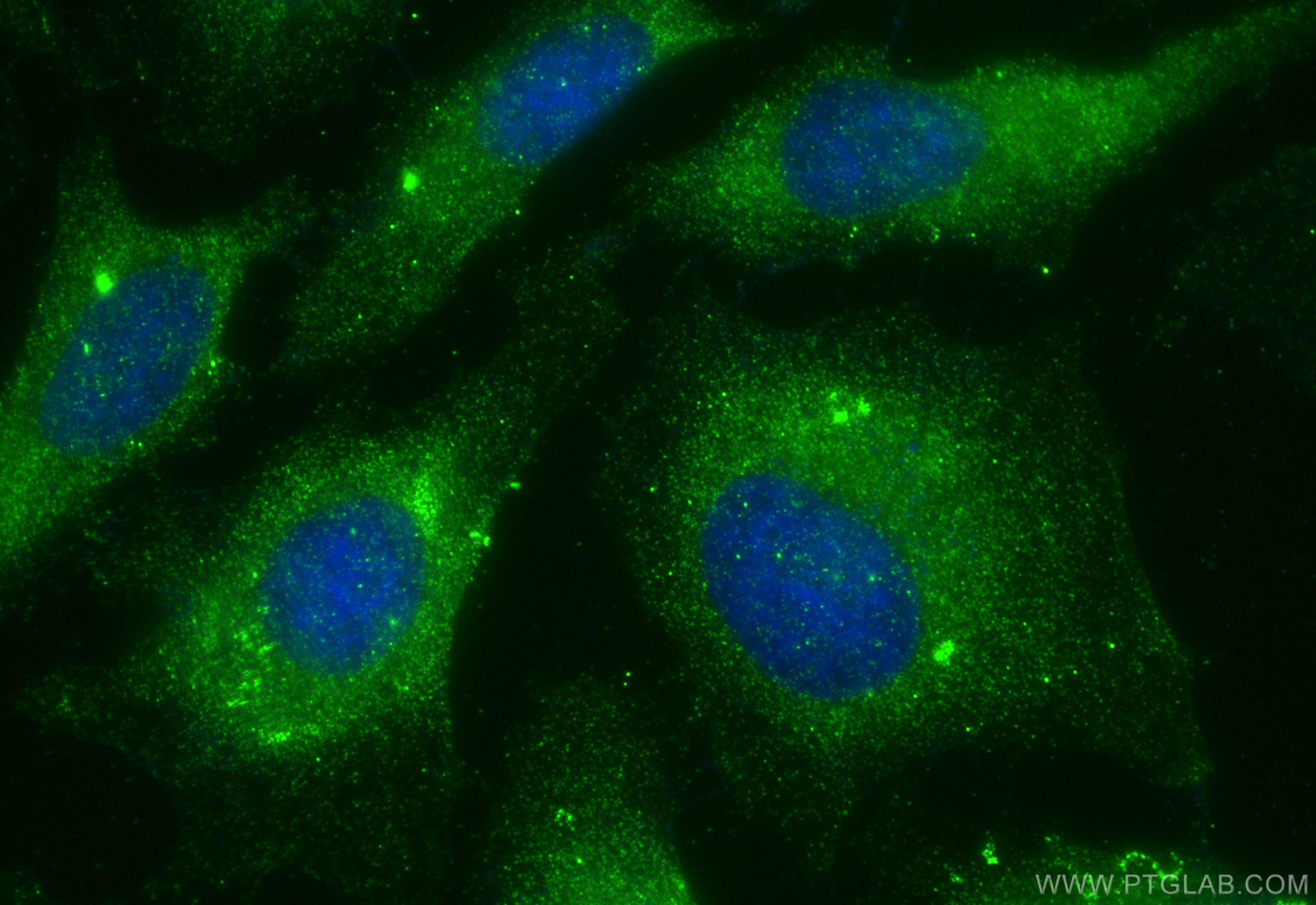 Immunofluorescence (IF) / fluorescent staining of HeLa cells using OS9 Polyclonal antibody (10061-1-AP)