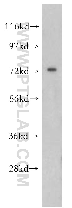 Western Blot (WB) analysis of HeLa cells using OS9 Polyclonal antibody (10061-1-AP)