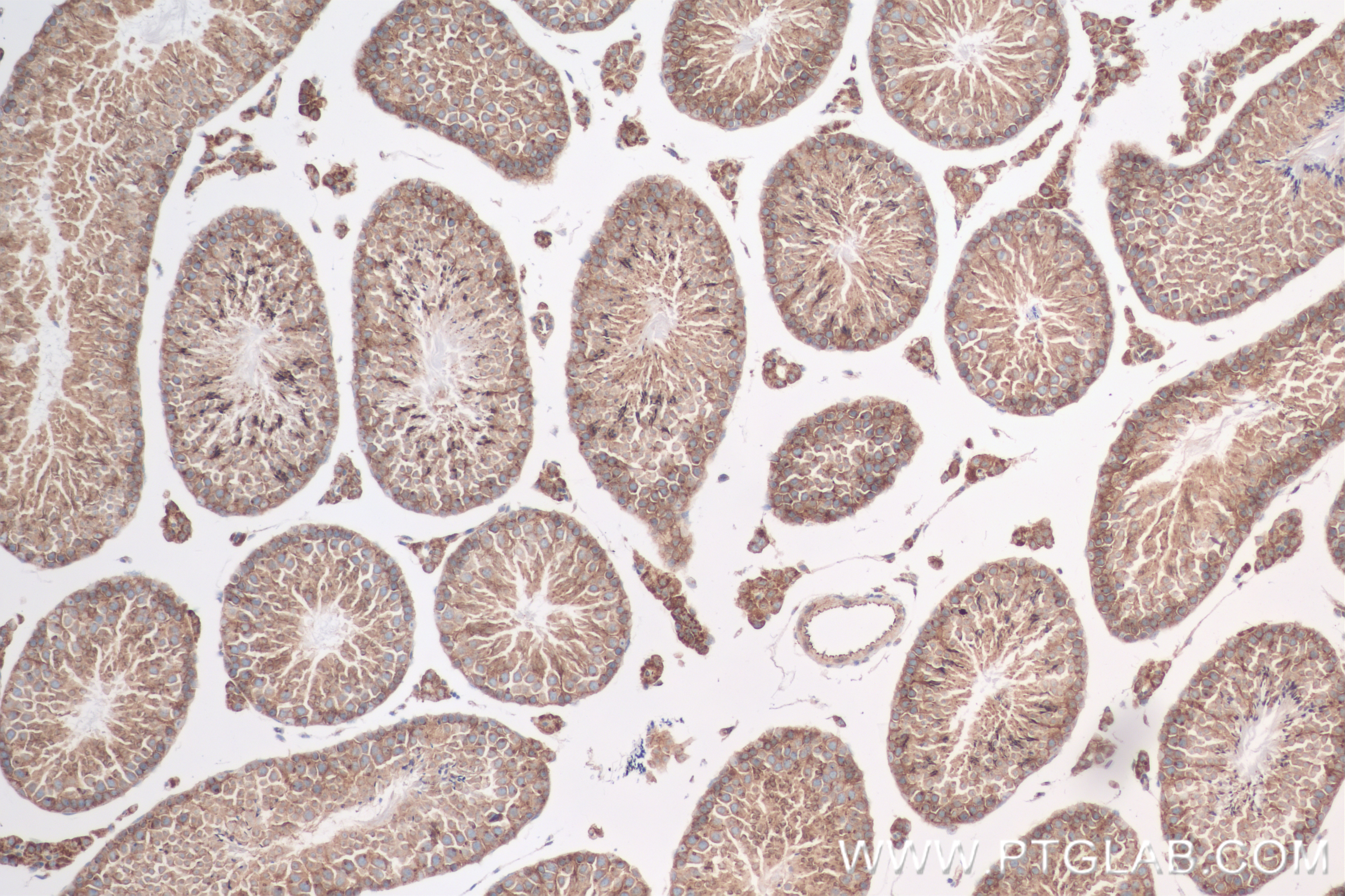 Immunohistochemistry (IHC) staining of mouse testis tissue using OS9 Recombinant antibody (82932-1-RR)