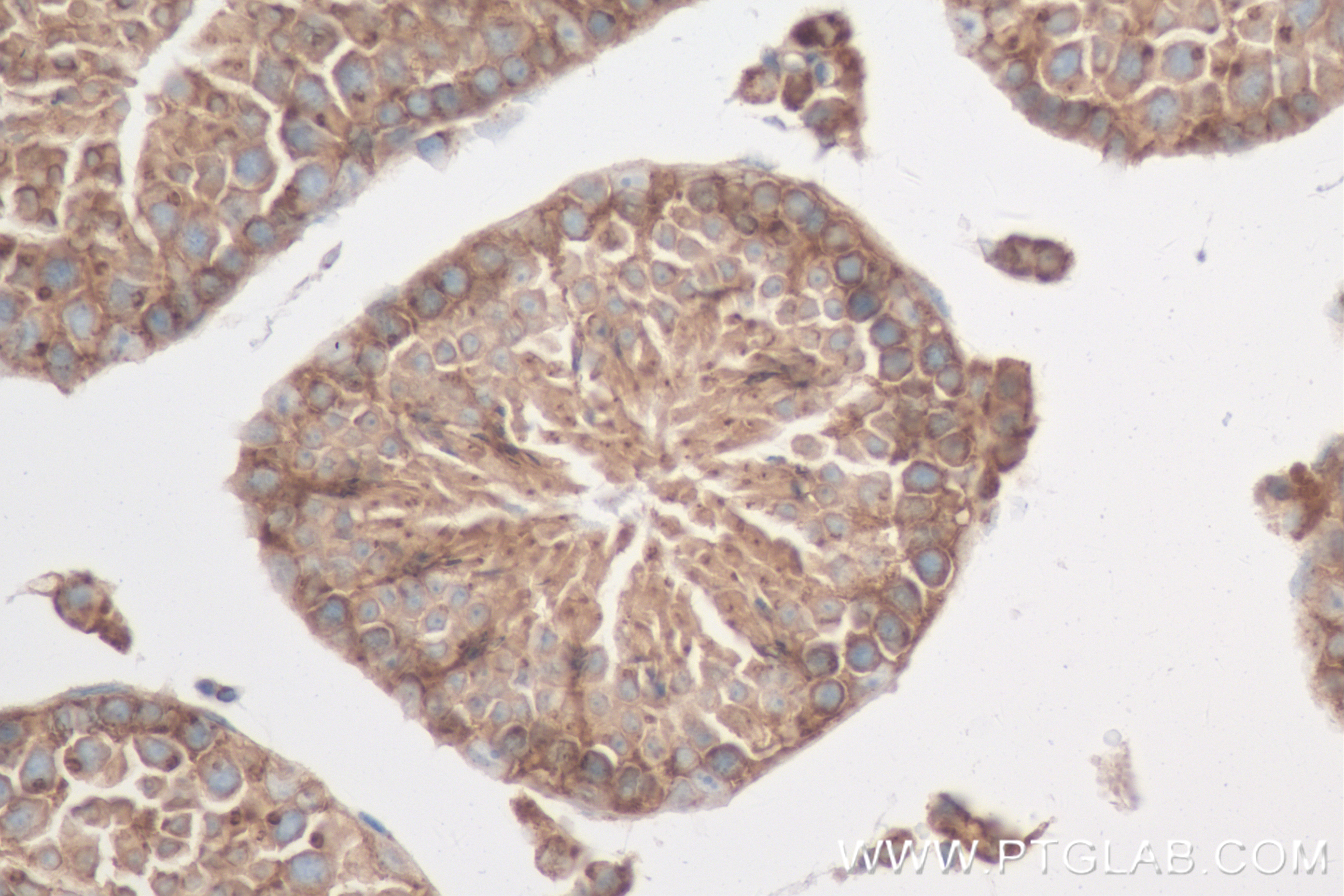 Immunohistochemistry (IHC) staining of mouse testis tissue using OS9 Recombinant antibody (82932-1-RR)