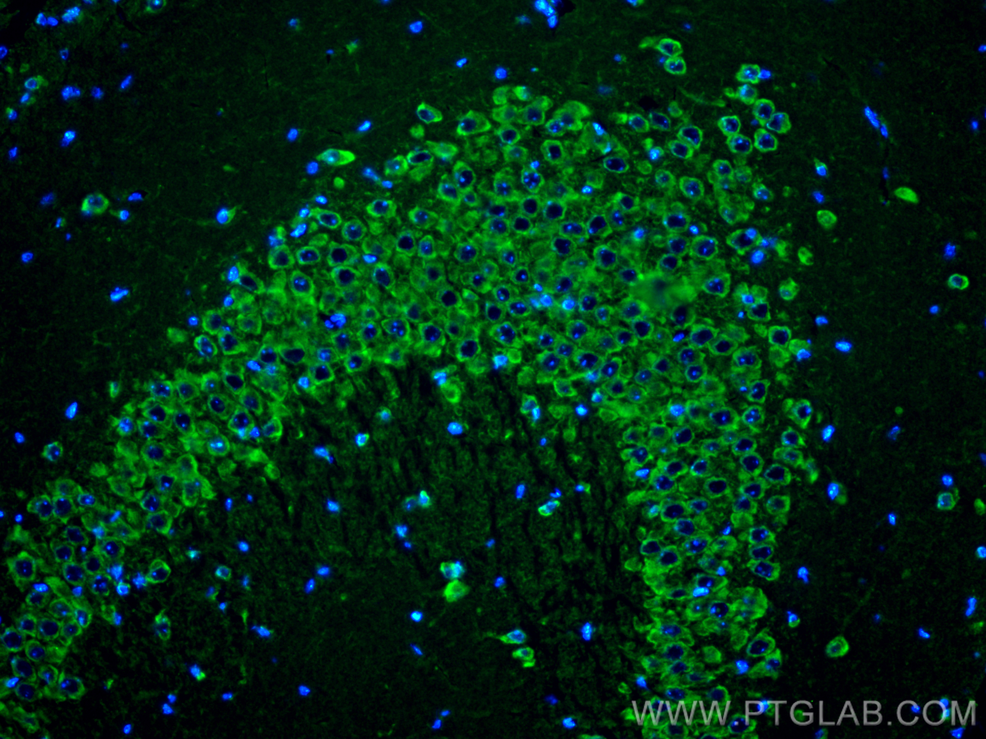 Immunofluorescence (IF) / fluorescent staining of mouse brain tissue using OSBPL2 Polyclonal antibody (14751-1-AP)