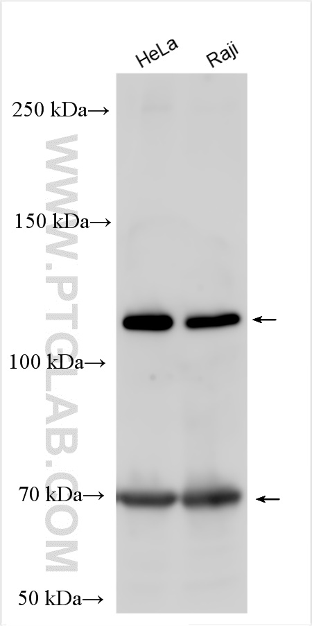 Western Blot (WB) analysis of various lysates using OSMR Polyclonal antibody (10982-1-AP)