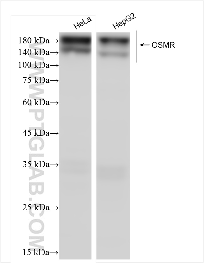 Western Blot (WB) analysis of various lysates using OSMR Recombinant antibody (84555-1-RR)