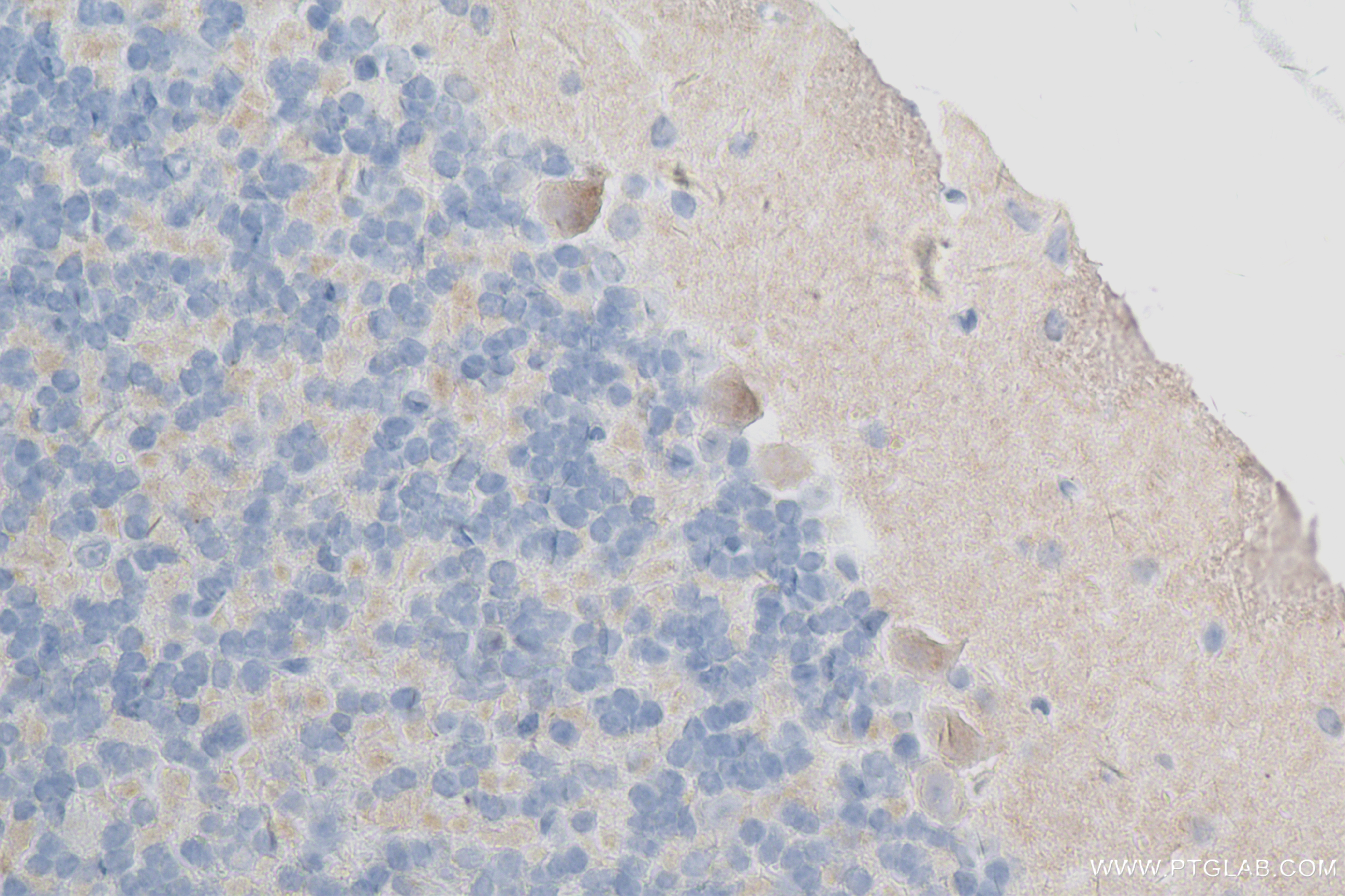 Immunohistochemistry (IHC) staining of mouse cerebellum tissue using OSMR Recombinant antibody (84555-2-RR)