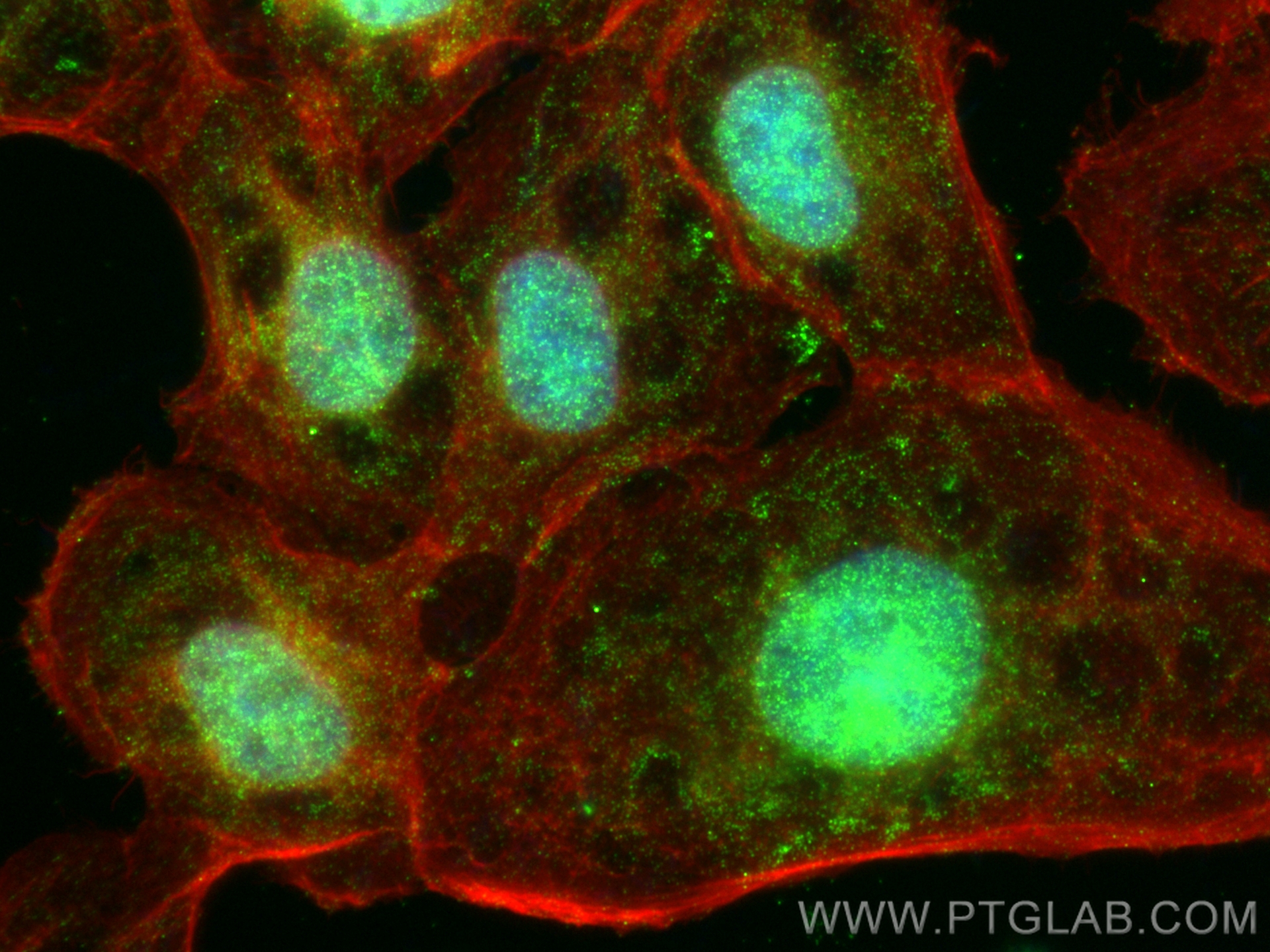 Immunofluorescence (IF) / fluorescent staining of A431 cells using OSTM1 Polyclonal antibody (14621-1-AP)