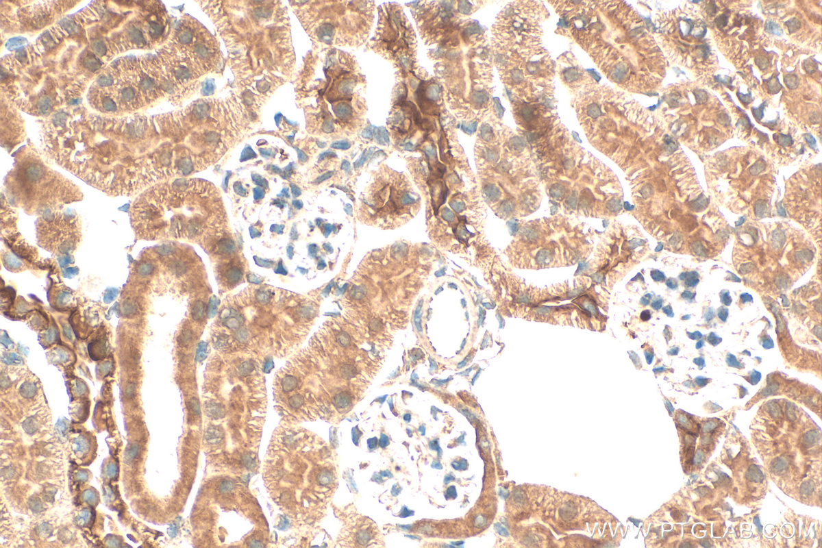 Immunohistochemistry (IHC) staining of mouse kidney tissue using OSTM1 Polyclonal antibody (14621-1-AP)