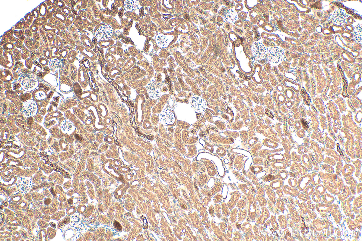 Immunohistochemistry (IHC) staining of mouse kidney tissue using OSTM1 Polyclonal antibody (14621-1-AP)