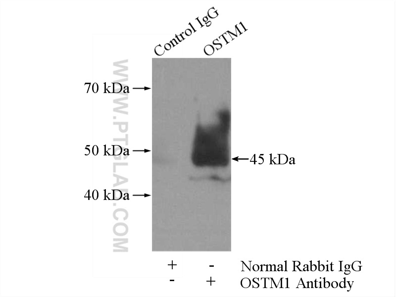 OSTM1