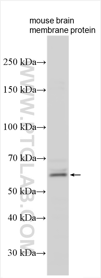 Western Blot (WB) analysis of various lysates using OSTM1 Polyclonal antibody (14621-1-AP)