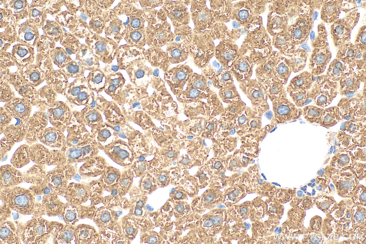 Immunohistochemistry (IHC) staining of mouse liver tissue using OTUD1 Polyclonal antibody (29921-1-AP)