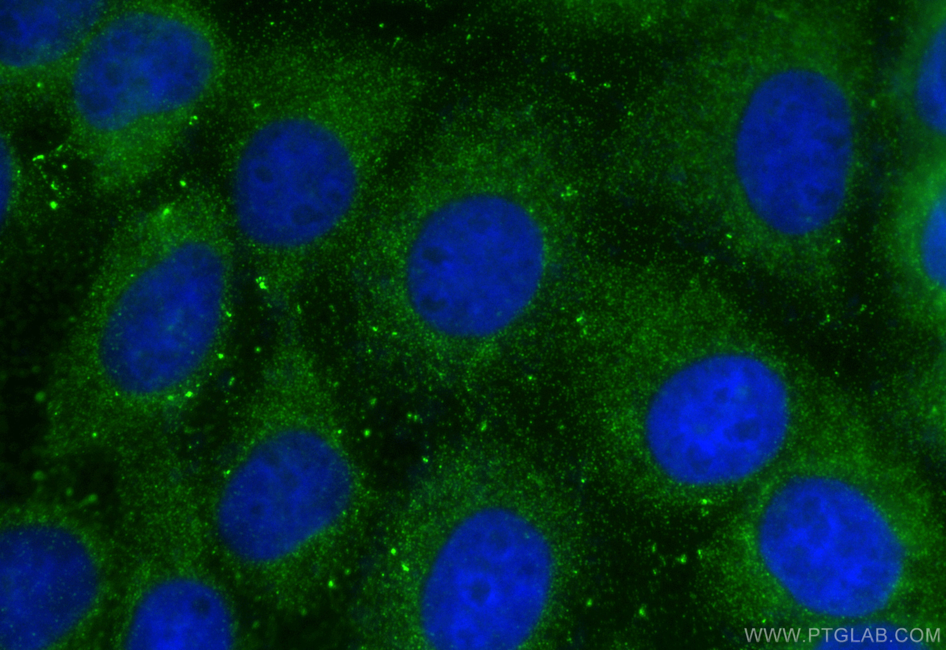 Immunofluorescence (IF) / fluorescent staining of A431 cells using OTUD5 Polyclonal antibody (21002-1-AP)