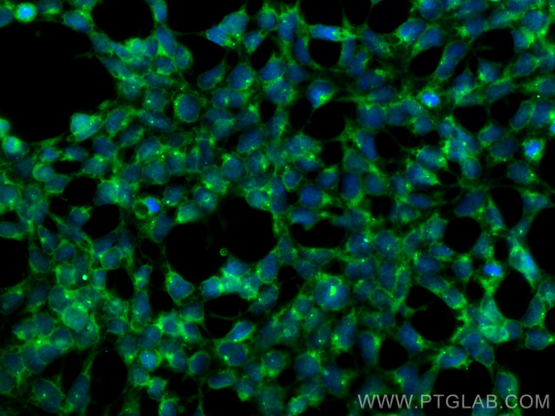 Immunofluorescence (IF) / fluorescent staining of HEK-293 cells using OTUD6A Polyclonal antibody (24486-1-AP)