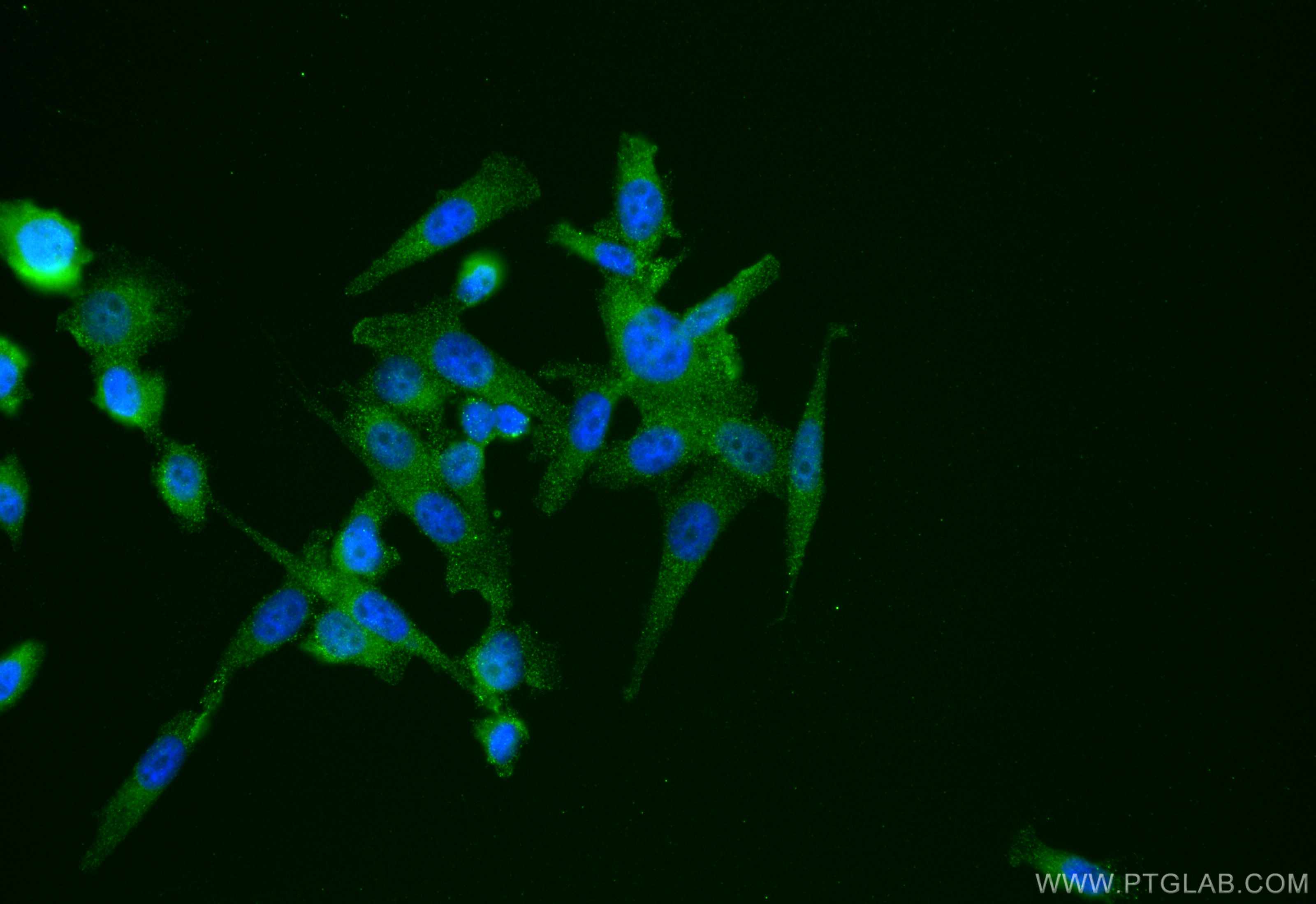 Immunofluorescence (IF) / fluorescent staining of PC-3 cells using OTUD6B Monoclonal antibody (68450-1-Ig)