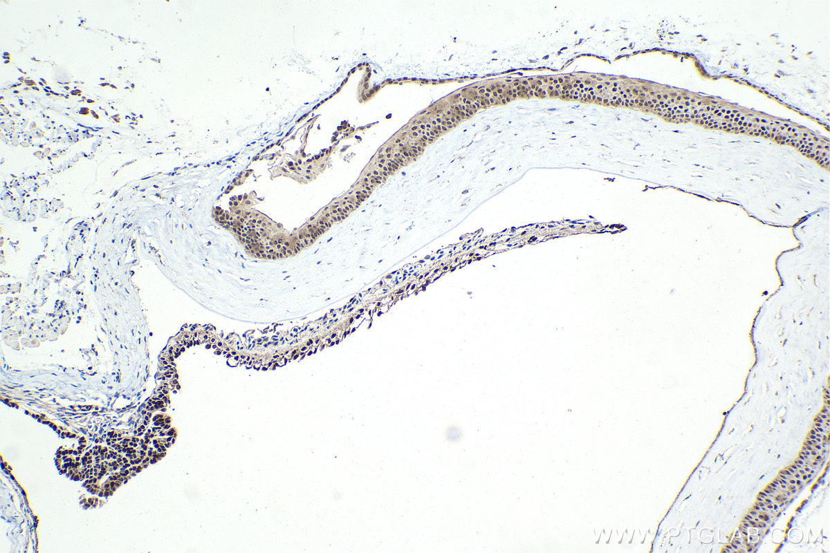 Immunohistochemistry (IHC) staining of mouse eye tissue using OTX2 Polyclonal antibody (13497-1-AP)