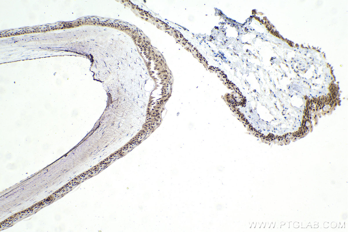 Immunohistochemistry (IHC) staining of rat eye tissue using OTX2 Polyclonal antibody (13497-1-AP)