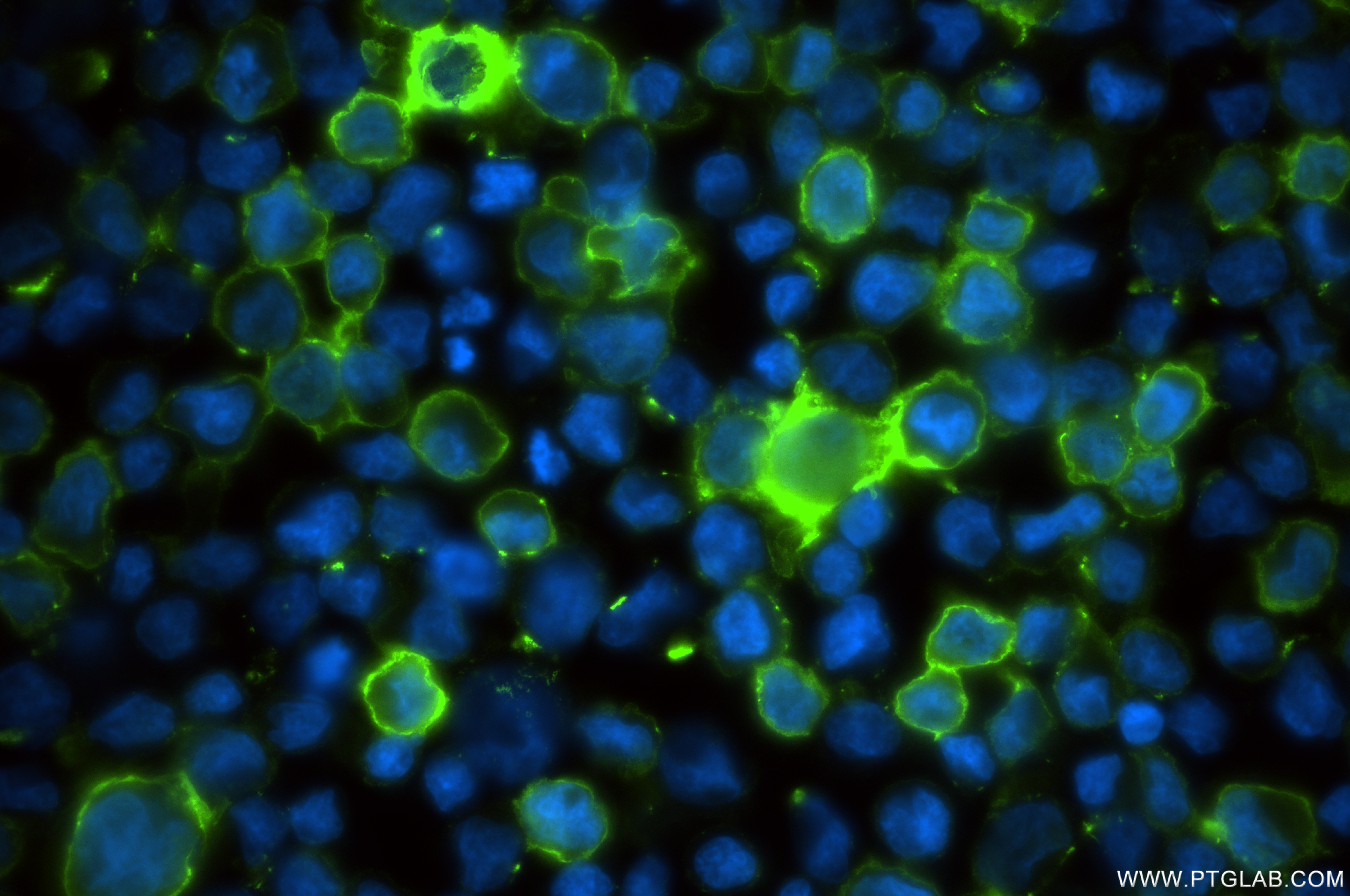 Immunofluorescence (IF) / fluorescent staining of MJ cells using OX40L/TNFSF4 Recombinant antibody (82794-7-RR)