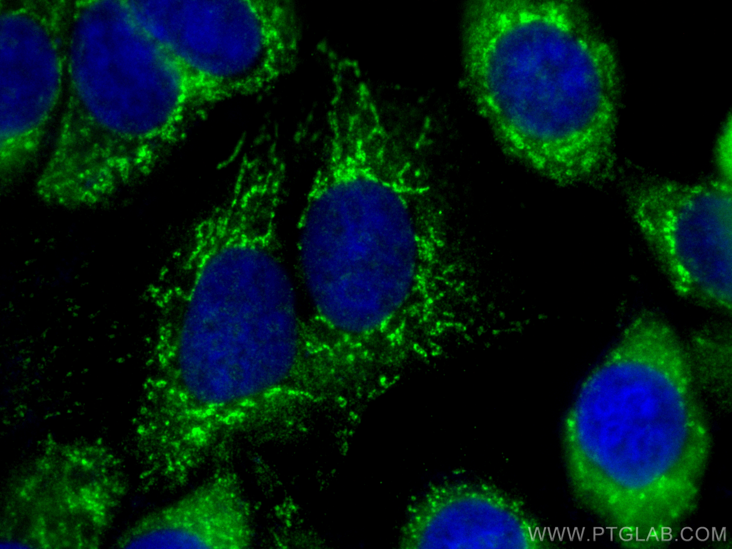 Immunofluorescence (IF) / fluorescent staining of MCF-7 cells using CoraLite® Plus 488-conjugated OXCT1 Recombinant an (CL488-81011)