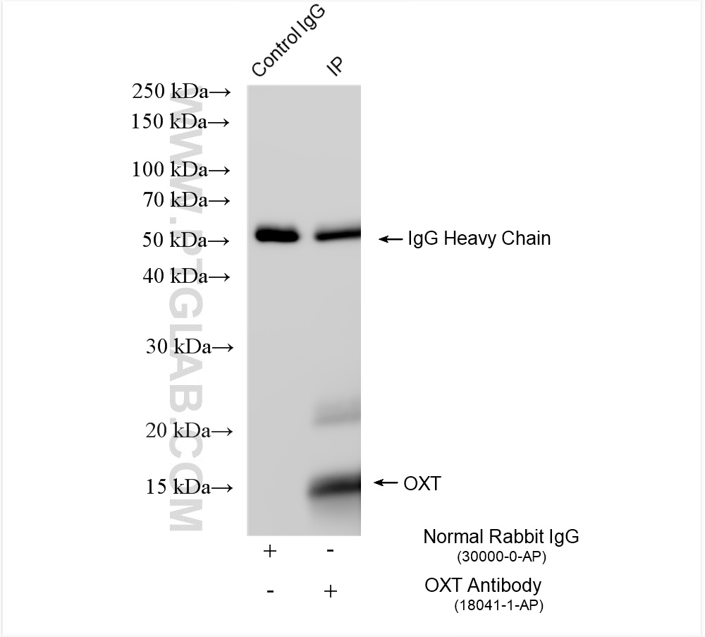 Immunoprecipitation (IP) experiment of mouse pituitary gland tissue using OXT Polyclonal antibody (18041-1-AP)