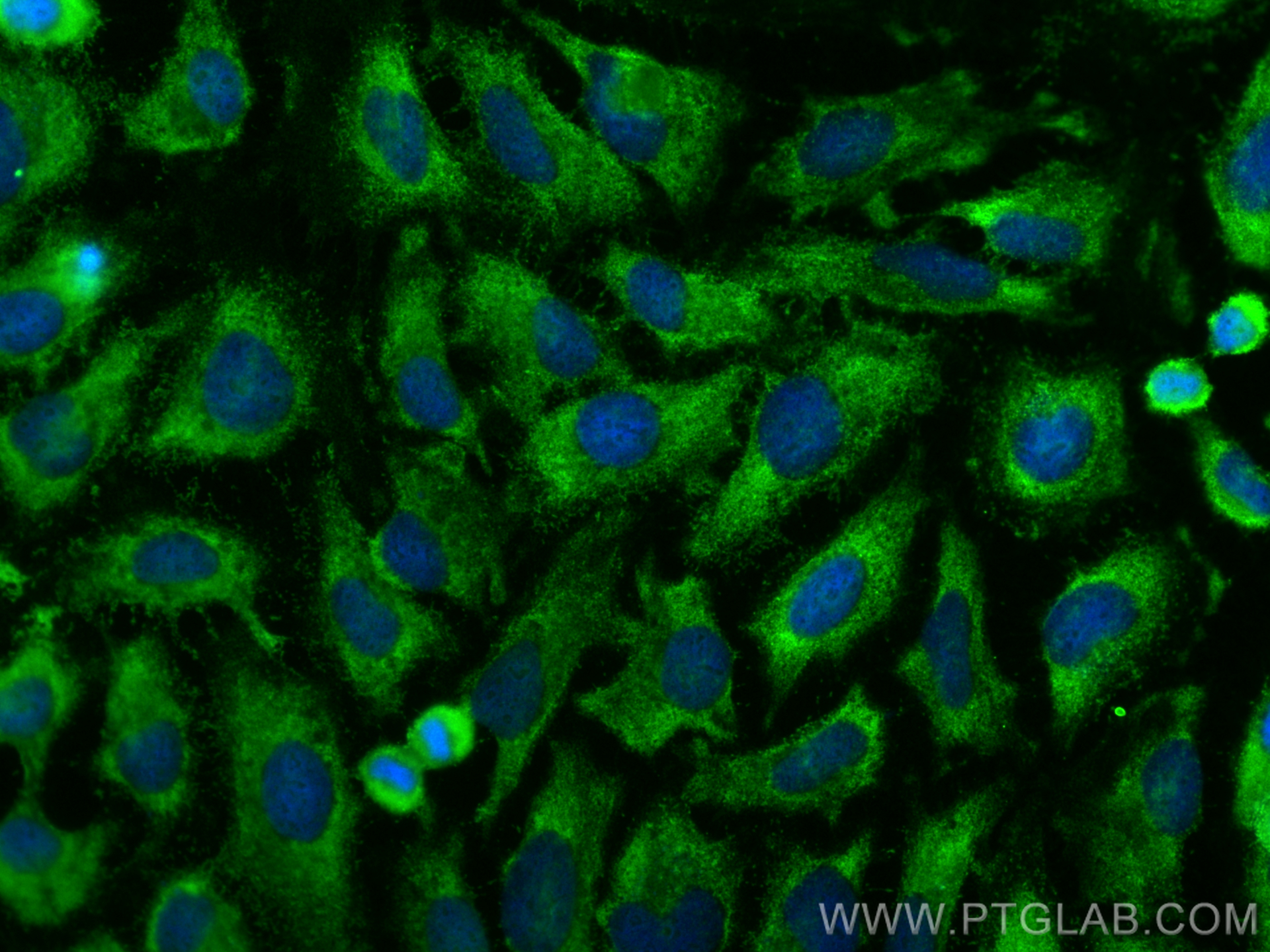 Immunofluorescence (IF) / fluorescent staining of HeLa cells using OXTR Polyclonal antibody (23045-1-AP)