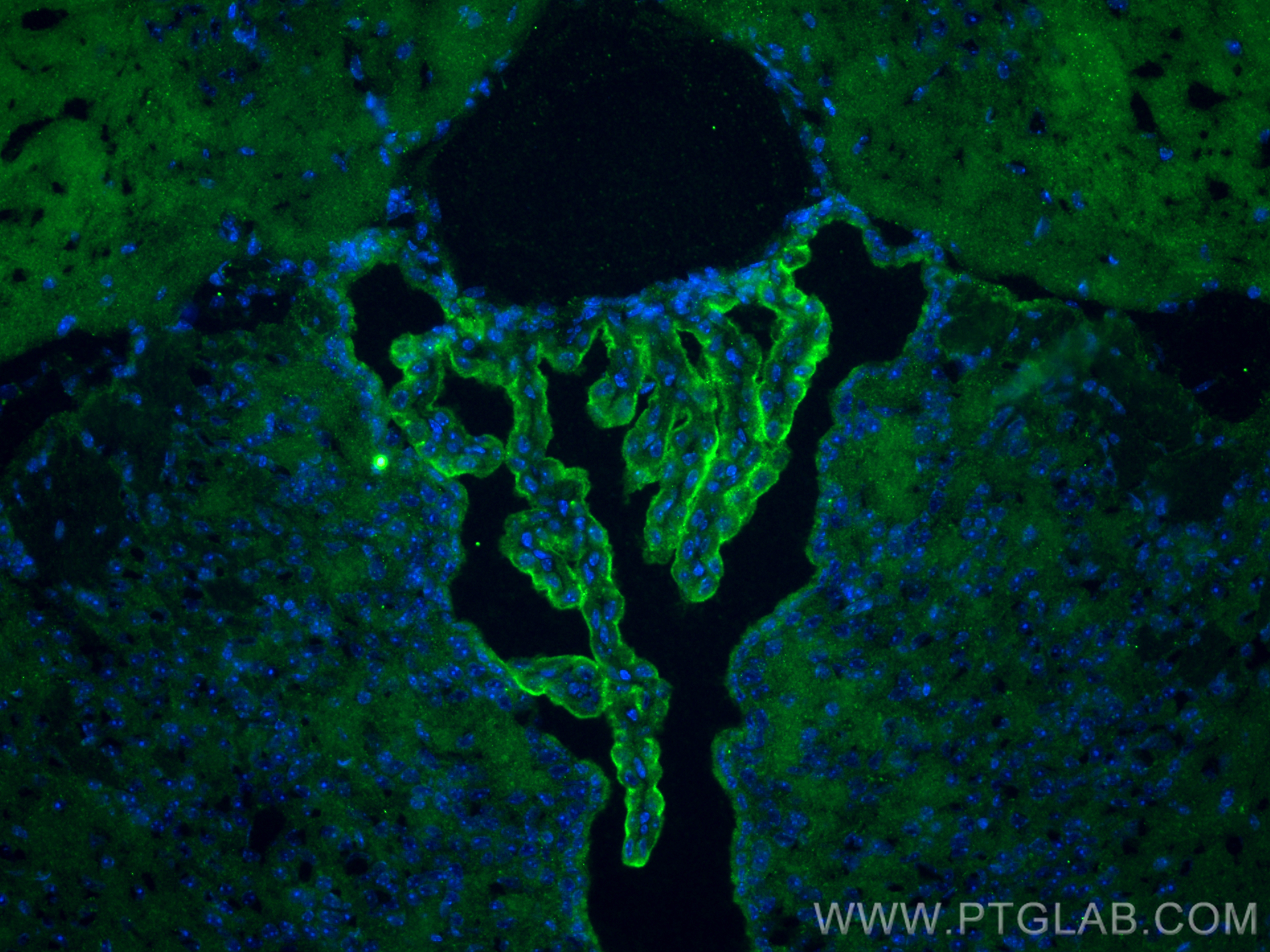 Immunofluorescence (IF) / fluorescent staining of mouse brain tissue using Occludin Polyclonal antibody (27260-1-AP)