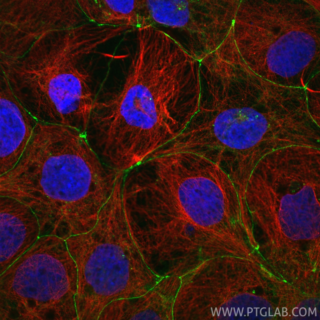 Immunofluorescence (IF) / fluorescent staining of Caco-2 cells using Occludin Polyclonal antibody (27260-1-AP)