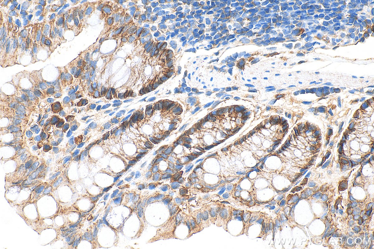 Immunohistochemistry (IHC) staining of mouse colon tissue using Occludin Polyclonal antibody (27260-1-AP)