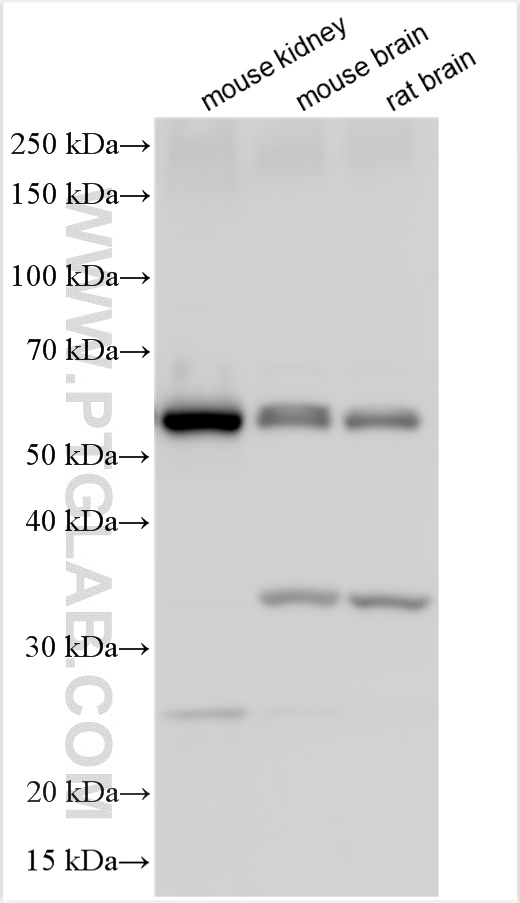 Western Blot (WB) analysis of various lysates using Occludin Polyclonal antibody (27260-1-AP)