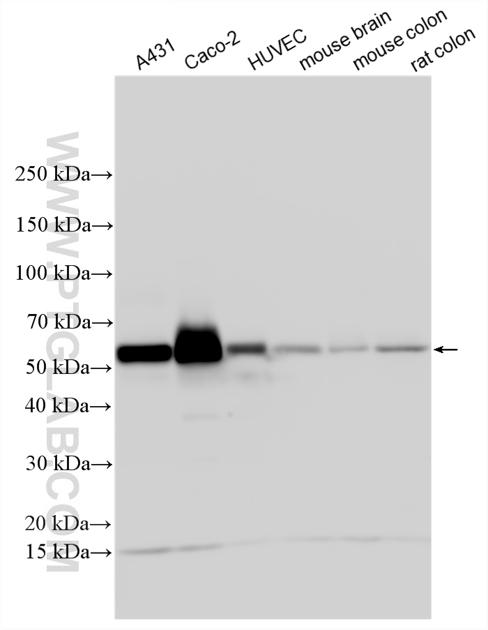 Western Blot (WB) analysis of various lysates using Occludin Polyclonal antibody (27260-1-AP)