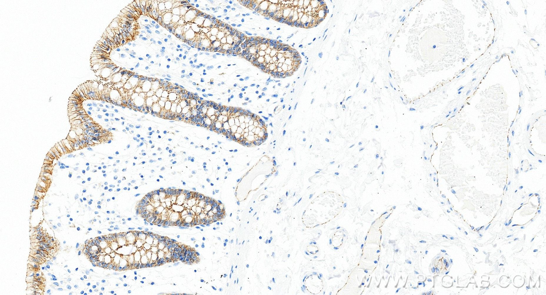 Immunohistochemistry (IHC) staining of human colon tissue using Occludin Recombinant monoclonal antibody (80545-1-RR)