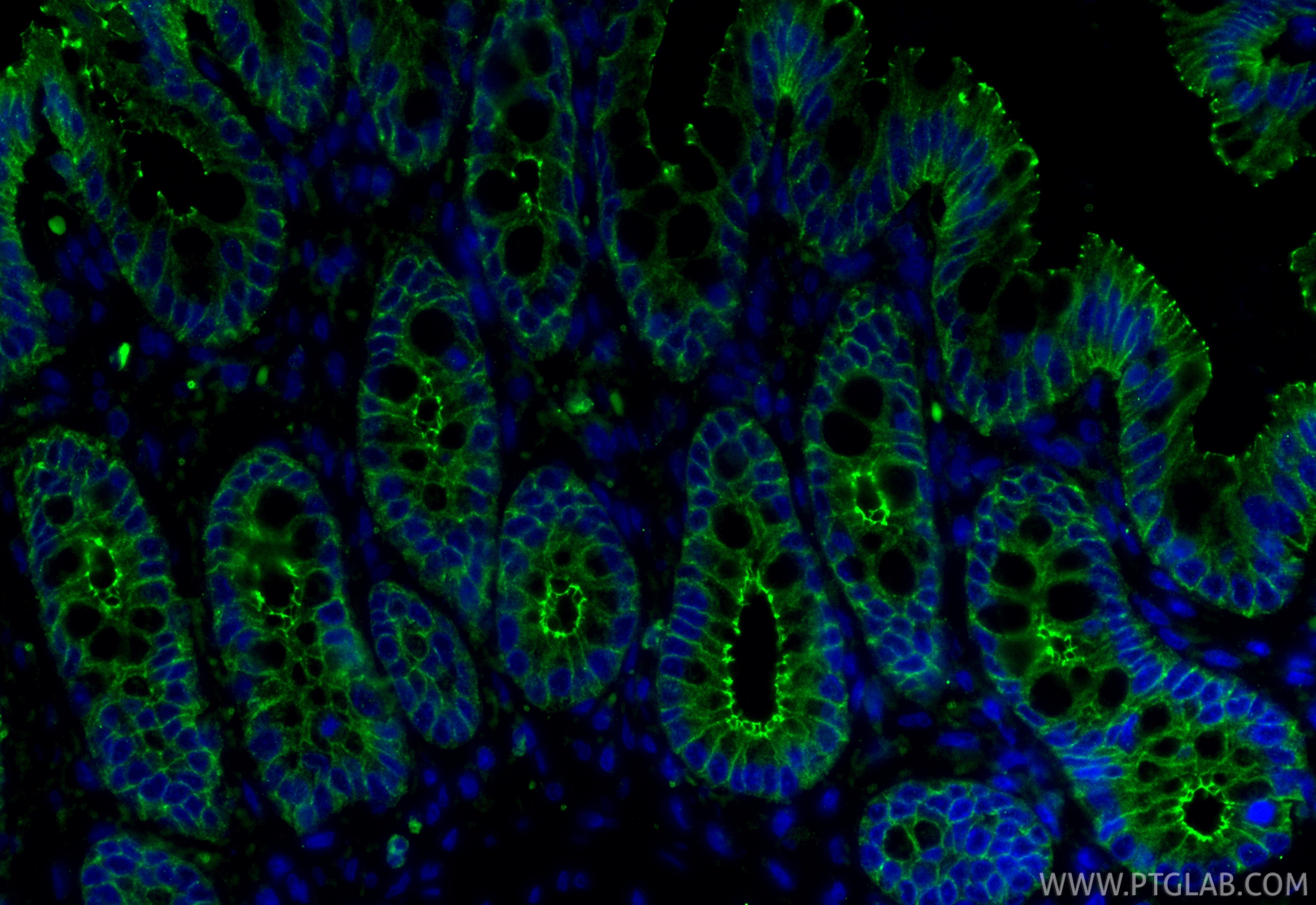 Immunofluorescence (IF) / fluorescent staining of rat colon tissue using Occludin Recombinant monoclonal antibody (80545-1-RR)