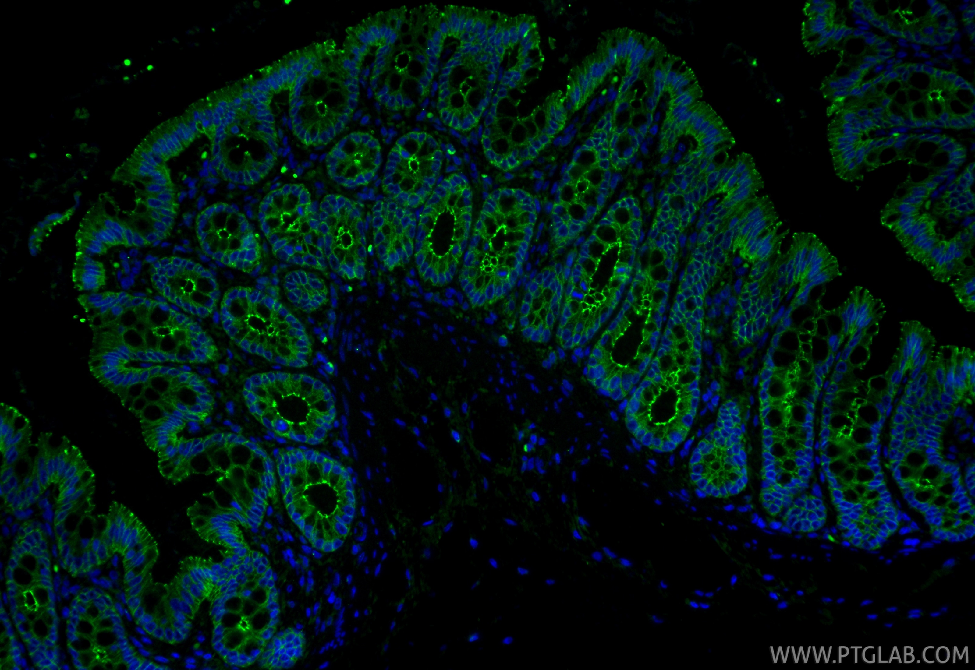 Immunofluorescence (IF) / fluorescent staining of rat colon tissue using Occludin Recombinant monoclonal antibody (80545-1-RR)