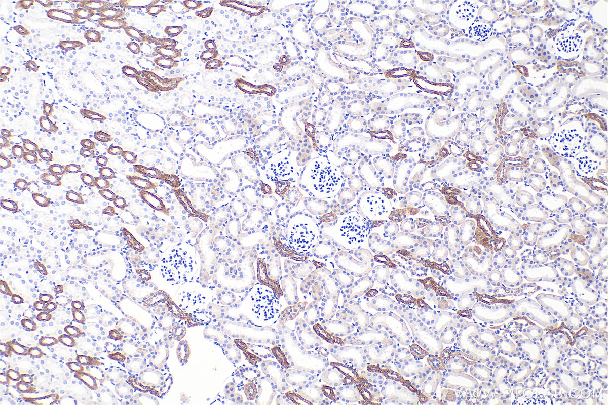 Immunohistochemistry (IHC) staining of mouse kidney tissue using Occludin Recombinant monoclonal antibody (80545-1-RR)