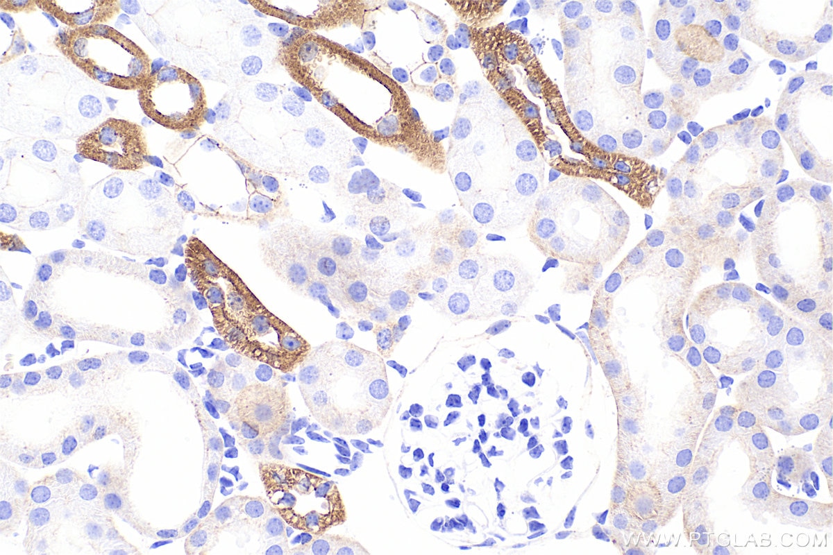 Immunohistochemistry (IHC) staining of mouse kidney tissue using Occludin Recombinant monoclonal antibody (80545-1-RR)