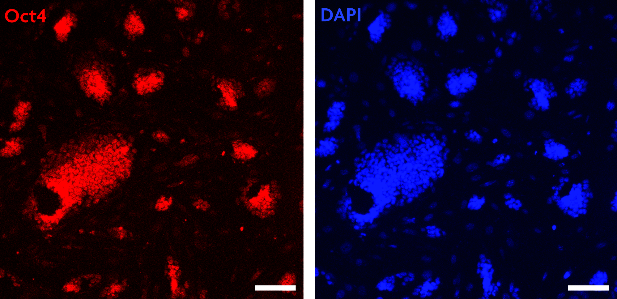 Oct-4 antibody (pAb) tested by Immunofluorescence Mouse embryonic stem cells (mESCs) grown on mouse embryonic fibroblast feeder cells (MEFs) were fixed with 4% paraformaldehyde for 10 minutes at room temperature. Cells were then permeabilized and blocked by incubating with Blocking Solution containing 5% serum/0.1% Triton X-100 in D-PBS for 2 hours at room temperature. Cells were then incubated with Oct-4 antibody (Catalog No. 39811, red) at 1:200 dilution overnight at 4°C, washed with D-PBS, and incubated for 2 hours at room temperature with goat anti-mouse Cy3 secondary antibody at 1:250 dilution. Nuclei were stained with DAPI (blue). Cells were visualized using a Zeiss fluorescent microscope at 20X magnification. Images show that Oct-4 antibody specifically stains mESC colonies and does not stain MEFs. Absence of Oct-4 staining in a subset of cells within the colonies suggests differentiation. Scale bars, 100 μm.