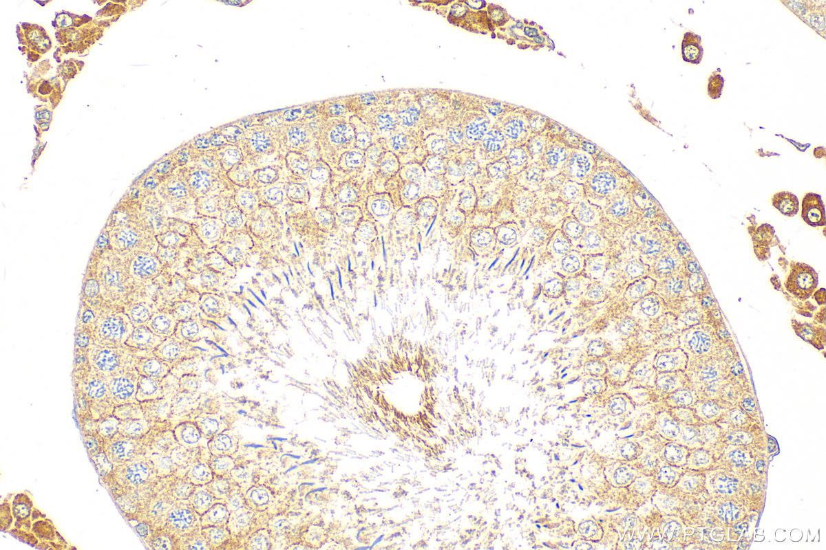 Immunohistochemistry (IHC) staining of rat testis tissue using Osteocalcin Polyclonal antibody (23418-1-AP)