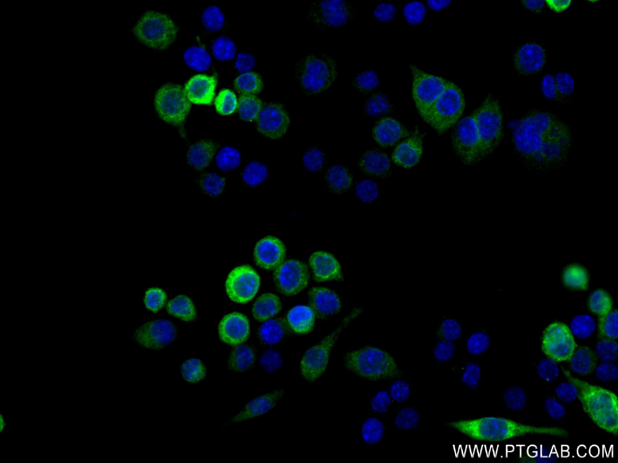 Immunofluorescence (IF) / fluorescent staining of RAW 264.7 cells using Osteopontin Recombinant antibody (83413-6-RR)