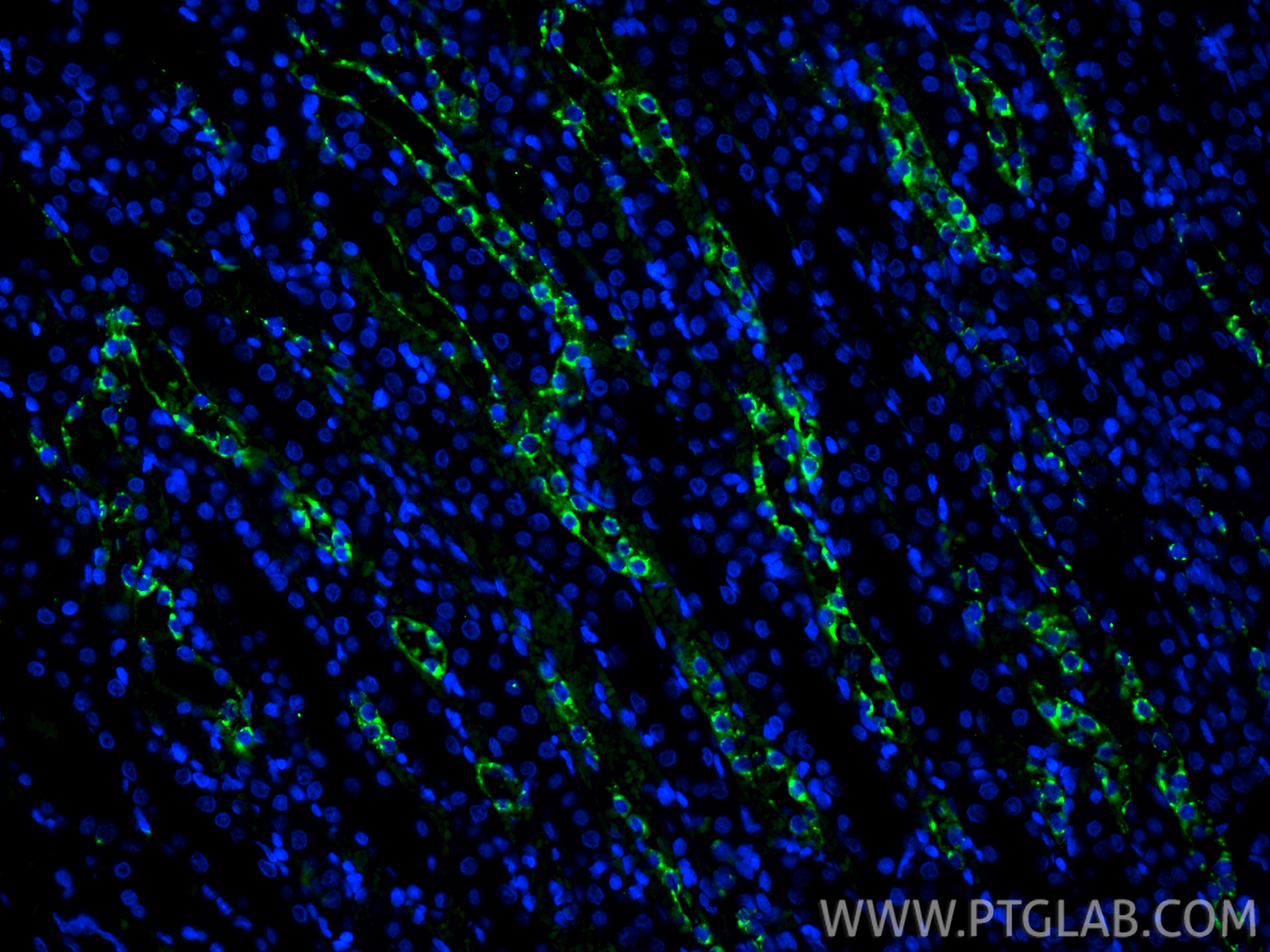 Immunofluorescence (IF) / fluorescent staining of rat kidney tissue using CoraLite® Plus 488-conjugated Osteopontin Polyclon (CL488-22952)