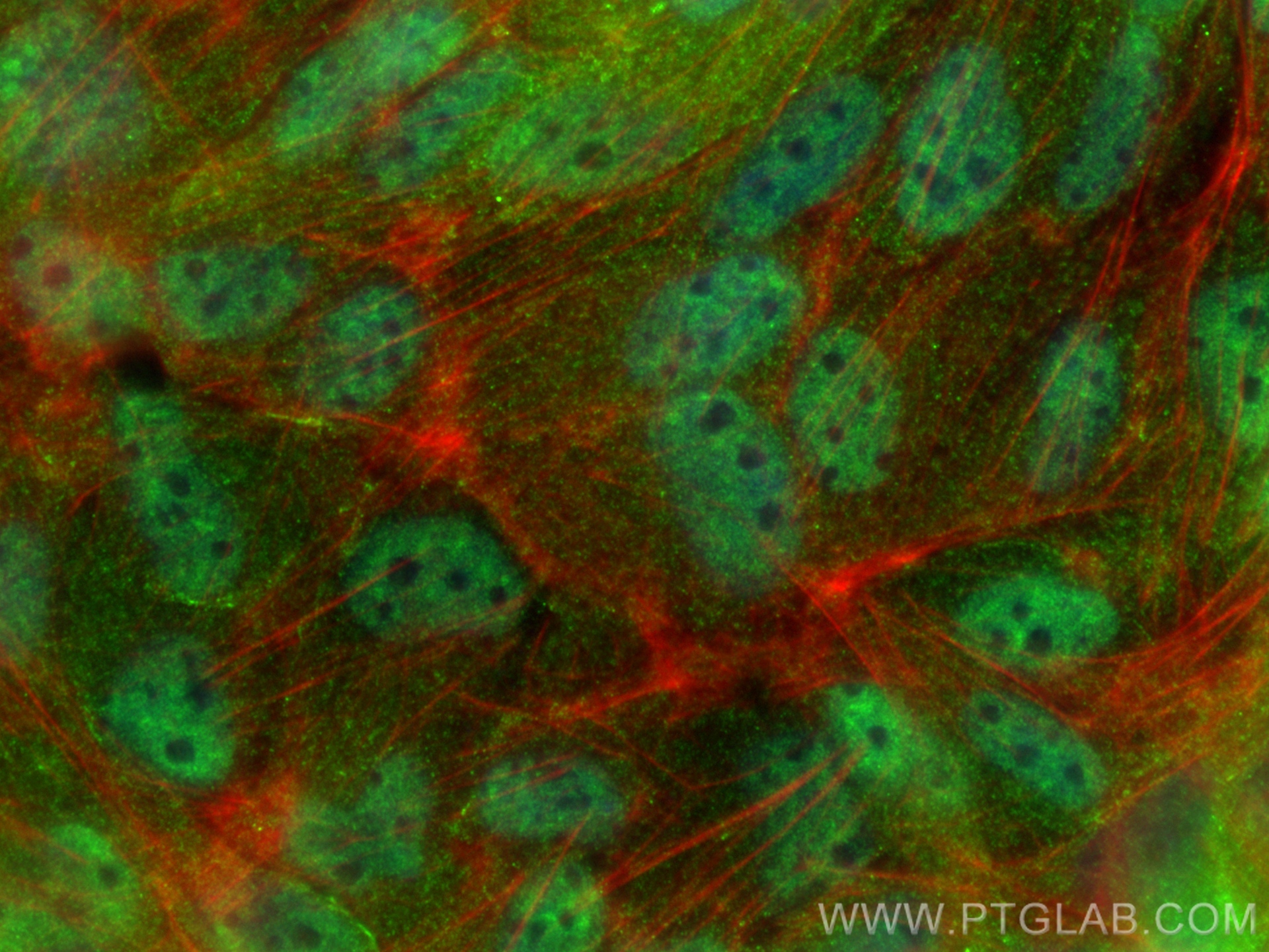 Immunofluorescence (IF) / fluorescent staining of MDCK cells using P16-INK4A Polyclonal antibody (10883-1-AP)