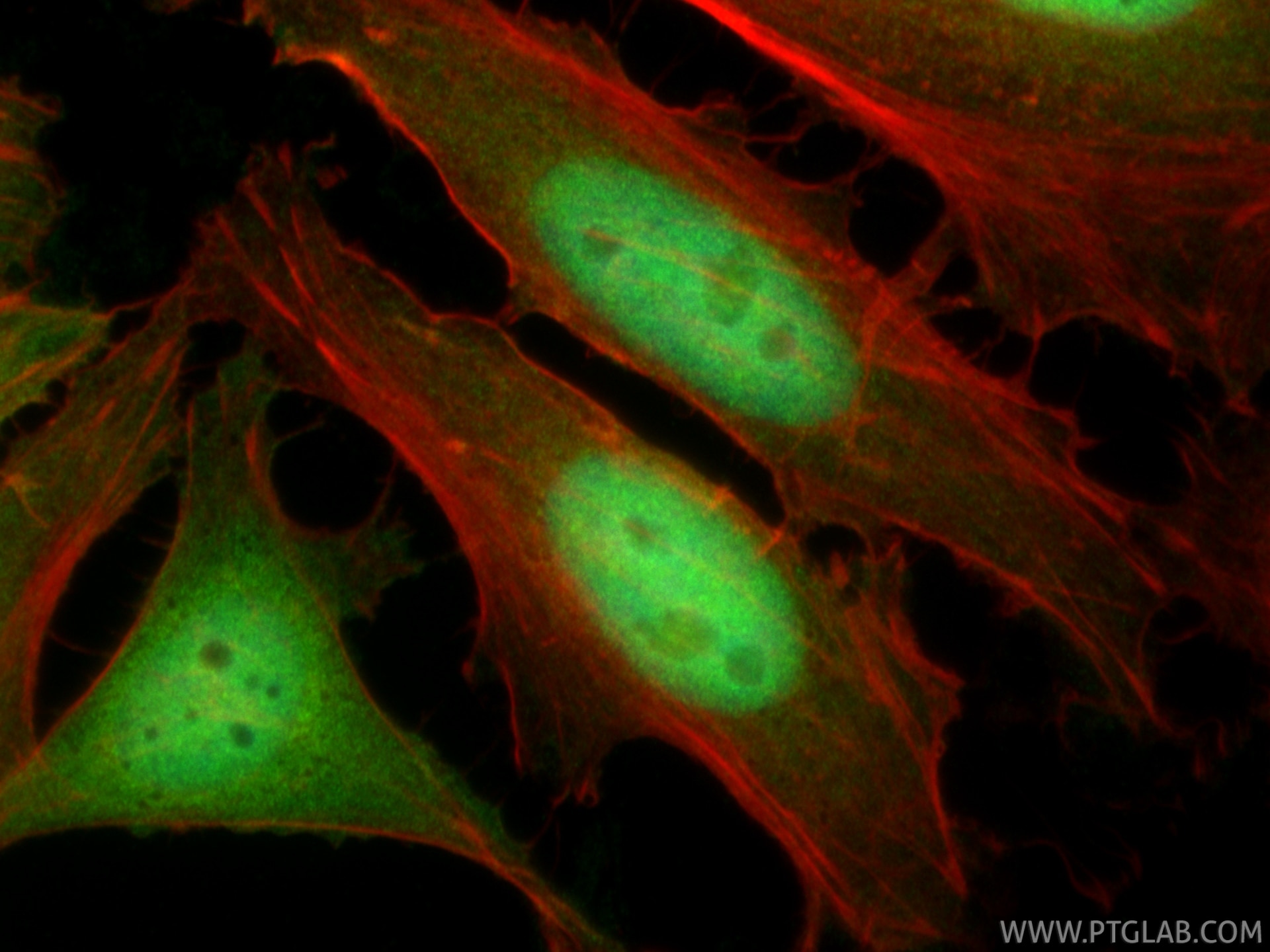 Immunofluorescence (IF) / fluorescent staining of HeLa cells using CDKN2A/P16-INK4A Polyclonal antibody (10883-1-AP)