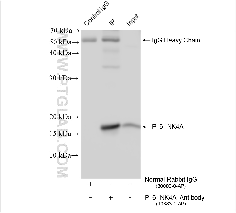 Immunoprecipitation (IP) experiment of HEK-293 cells using P16-INK4A Polyclonal antibody (10883-1-AP)