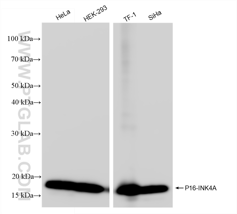 Western Blot (WB) analysis of various lysates using P16-INK4A Recombinant antibody (81373-8-RR)