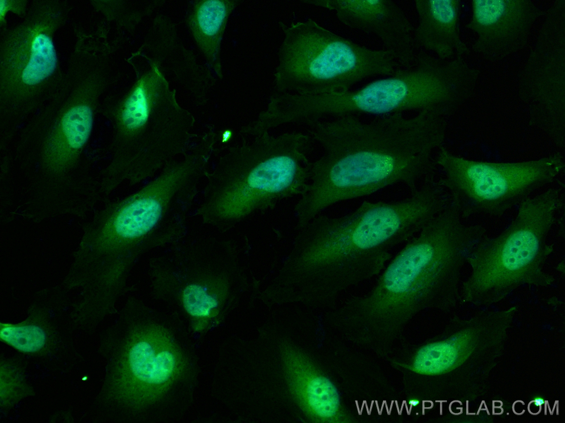 Immunofluorescence (IF) / fluorescent staining of HeLa cells using CoraLite® Plus 488-conjugated P16-INK4A Polyclonal (CL488-10883)