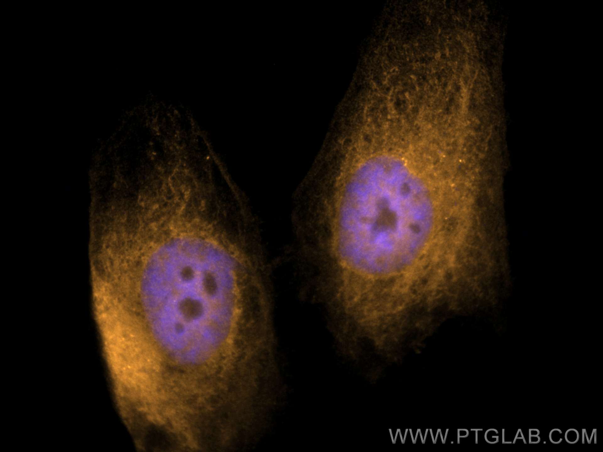 Immunofluorescence (IF) / fluorescent staining of HeLa cells using CoraLite®555-conjugated P16-INK4A Polyclonal antib (CL555-10883)