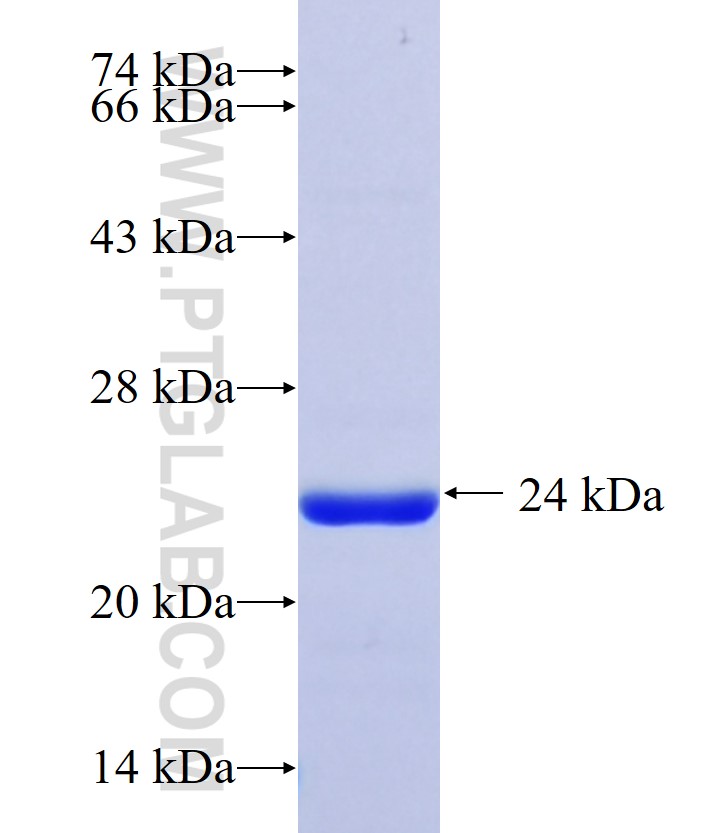 P19 fusion protein Ag28546 SDS-PAGE