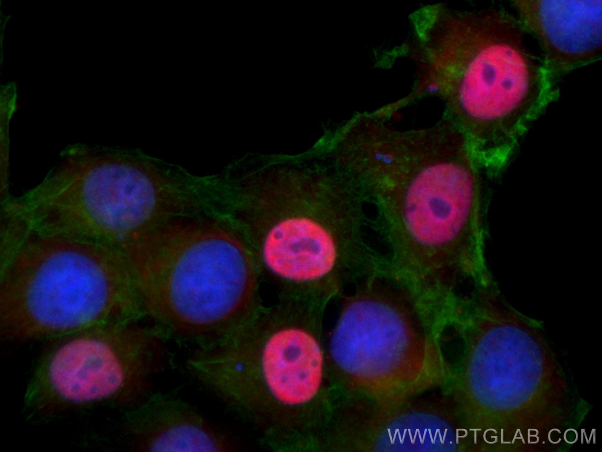 Immunofluorescence (IF) / fluorescent staining of MCF-7 cells using P21 Polyclonal antibody (10355-1-AP)