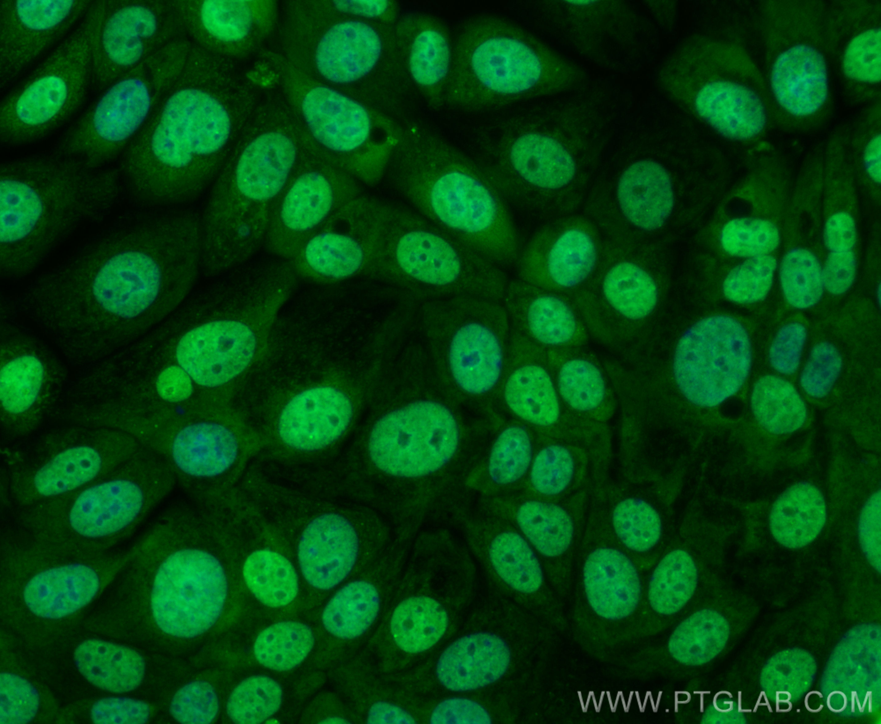 Immunofluorescence (IF) / fluorescent staining of MCF-7 cells using CoraLite® Plus 488-conjugated P21 Recombinant anti (CL488-82669-2)